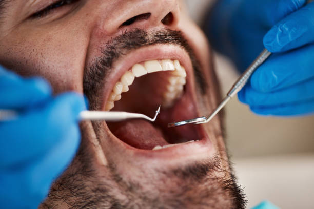 Best Emergency Treatment for Oral Infections in Winnfield, LA